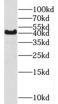 PRMT6 Rabbit Polyclonal Antibody