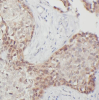 PRMT6 Rabbit Polyclonal Antibody