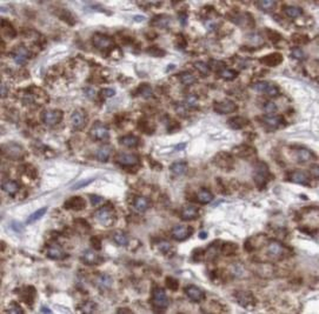 PHB1 Rabbit Polyclonal Antibody