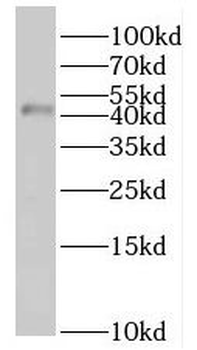 SERPINA5 Rabbit Polyclonal Antibody