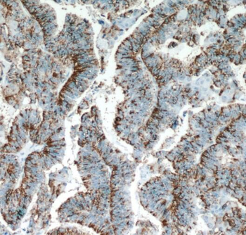 SERPINA5 Rabbit Polyclonal Antibody