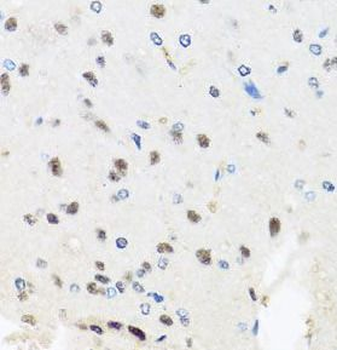 PRPF8 Rabbit Polyclonal Antibody