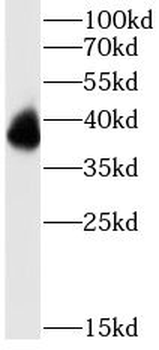 PRPH2 Rabbit Polyclonal Antibody