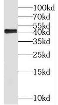 PRPSAP2 Rabbit Polyclonal Antibody