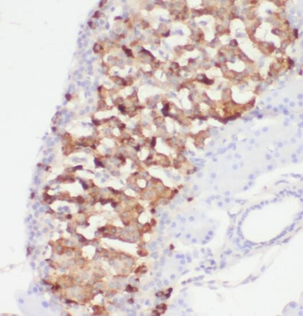 PRPSAP2 Rabbit Polyclonal Antibody