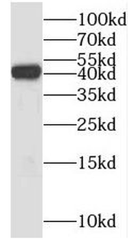 PSAT1 Rabbit Polyclonal Antibody