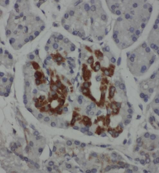 PSAT1 Rabbit Polyclonal Antibody
