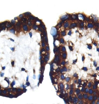 PSG1 Rabbit Polyclonal Antibody