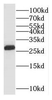PSMA3 Rabbit Polyclonal Antibody