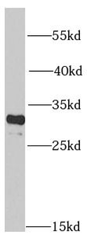 PSMA4 Rabbit Polyclonal Antibody
