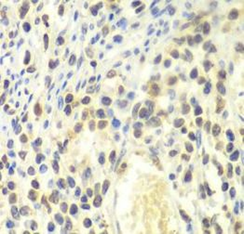 PSMA4 Rabbit Polyclonal Antibody