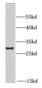 PSMA6 Rabbit Polyclonal Antibody
