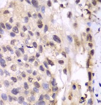 PSMA6 Rabbit Polyclonal Antibody