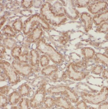 PSMA8 Rabbit Polyclonal Antibody
