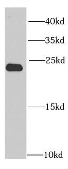 PSMB2 Rabbit Polyclonal Antibody