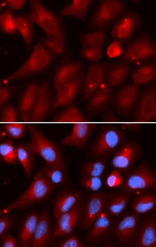 PSMB2 Rabbit Polyclonal Antibody