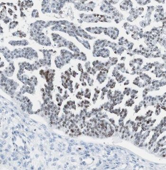 PSMB2 Rabbit Polyclonal Antibody