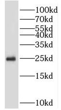 PSMB4 Rabbit Polyclonal Antibody