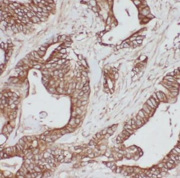 PSMB7 Rabbit Polyclonal Antibody