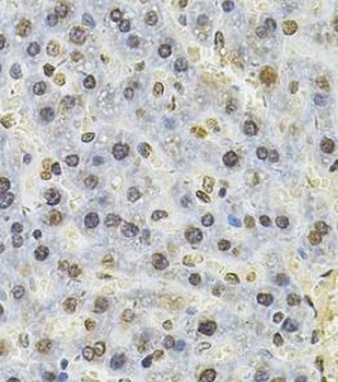 PSMC3 Rabbit Polyclonal Antibody