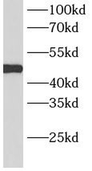 PSMC4 Rabbit Polyclonal Antibody