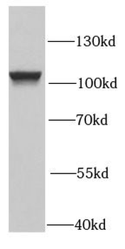 PSMD2 Rabbit Polyclonal Antibody