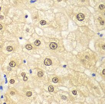 PSMD2 Rabbit Polyclonal Antibody