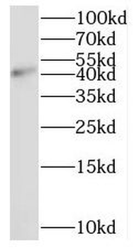 PSMD6 Rabbit Polyclonal Antibody