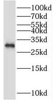 PSME3 Rabbit Polyclonal Antibody