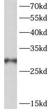 PSMG2 Rabbit Polyclonal Antibody