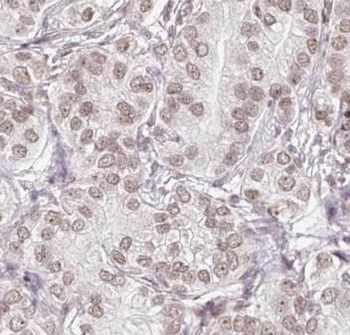 PSMG2 Rabbit Polyclonal Antibody