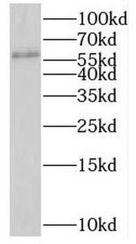 PTBP2 Rabbit Polyclonal Antibody