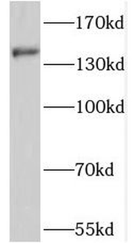 PTCH2 Rabbit Polyclonal Antibody