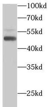 PTEN Mouse Monoclonal Antibody