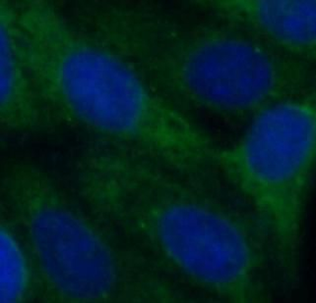 PTEN Mouse Monoclonal Antibody