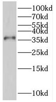 PTGR1 Rabbit Polyclonal Antibody
