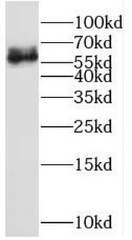 PTH2R Antibody