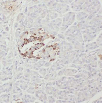 PTH2R Antibody