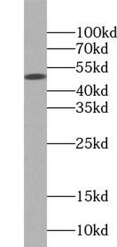 PTPN1 Rabbit Polyclonal Antibody