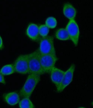 PTPN1 Rabbit Polyclonal Antibody
