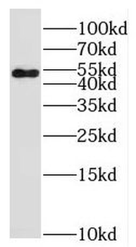 PTP4A1 Rabbit Polyclonal Antibody