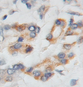 PTP4A1 Rabbit Polyclonal Antibody