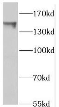 PTPN14 Rabbit Polyclonal Antibody