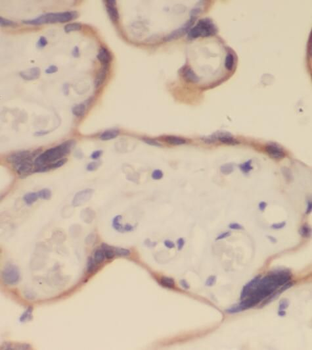 PTPN14 Rabbit Polyclonal Antibody