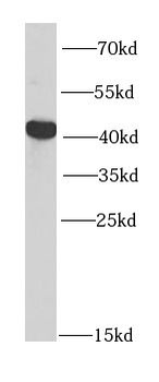 PTPN2 Rabbit Polyclonal Antibody