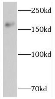 PTPN23 Rabbit Polyclonal Antibody