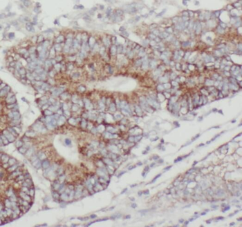 PTPN23 Rabbit Polyclonal Antibody