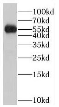 PTPN4 Rabbit Polyclonal Antibody