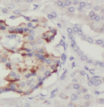 PTPN4 Rabbit Polyclonal Antibody