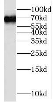 PTPN9 Rabbit Polyclonal Antibody